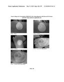 FOAMABLE FORMULATION diagram and image