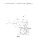 INFLATABLE EAR DEVICE diagram and image