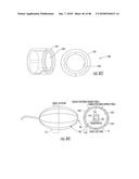 INFLATABLE EAR DEVICE diagram and image