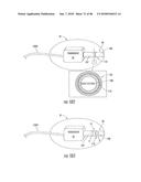 INFLATABLE EAR DEVICE diagram and image