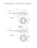 INFLATABLE EAR DEVICE diagram and image