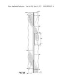 Pocketed Spring Assembly Comprising Strings of Springs Having Non-Linear     Separating Seams diagram and image