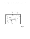 DEVICE TO SET AND RETRIEVE A REFERENCE POINT DURING A SURGICAL PROCEDURE diagram and image