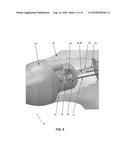 STEARABLE MICRO-ENDOSCOPE AND ZIP CATHETER diagram and image