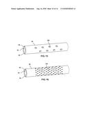 STEARABLE MICRO-ENDOSCOPE AND ZIP CATHETER diagram and image