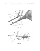 STEARABLE MICRO-ENDOSCOPE AND ZIP CATHETER diagram and image