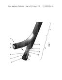 STEERABLE MICRO-ENDOSCOPE diagram and image