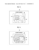 ENDOSCOPE SYSTEM, PROCESSOR DEVICE, AND OPERATION METHOD OF ENDOSCOPE     SYSTEM diagram and image