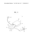 VIBRATION TRANSDUCER AND IMPLANTABLE HEARING AID DEVICE diagram and image