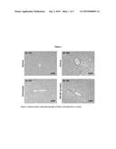 TREATMENT OF NON-ALCOHOLIC FATTY LIVER DISEASE OR NON-ALCOHOLIC     STEATOHEPATITIS WITH DELAYED-RELEASE 6-MERCAPTOPURINE diagram and image